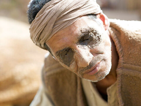 O homem ainda tinha o barro lamacento que Jesus havia colocado em seus olhos. – Slide número 8