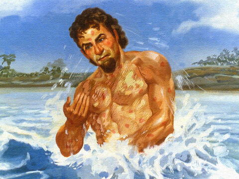 Por seis vezes Naamã abaixou na água e seu corpo permanecia igual. – Slide número 48